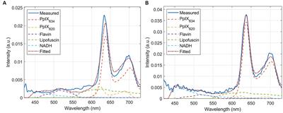 Unraveling the blue shift in porphyrin fluorescence in glioma: The 620 nm peak and its potential significance in tumor biology